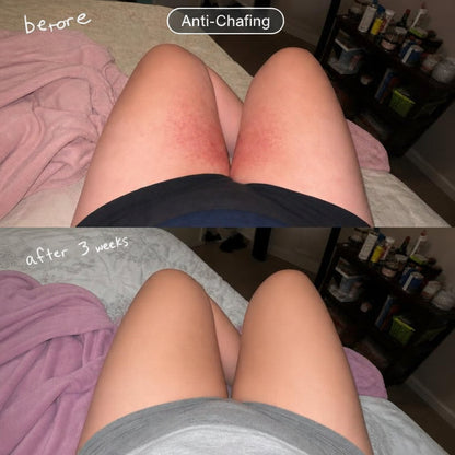 3D™ Anti-Chafe Shorts – Glide & Smooth
